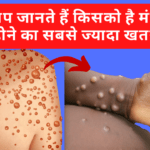 क्या आप जानते हैं किसको है मंकीपॉक्स होने का सबसे ज्यादा खतरा?